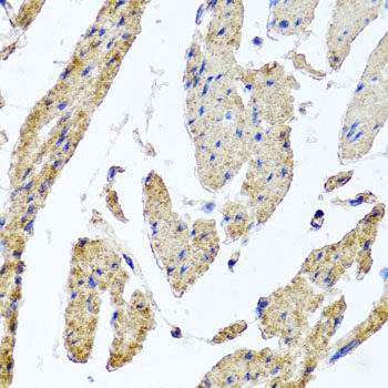 Immunohistochemistry of paraffin-embedded Human stomach using PCDHA12 Polyclonal Antibody at dilution of 1:100 (40x lens).
