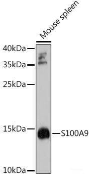 Western blot analysis of extracts from PC14 cells using Phospho-c-JUN(S73) Polyclonal Antibody.