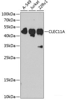 Immunofluorescence analysis of C6 cells using RPL23 Polyclonal Antibody at dilution of 1:100. Blue: DAPI for nuclear staining.