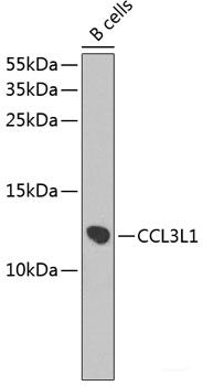 Western blot analysis of extracts of Mouse brain using SPHK2 Polyclonal Antibody.