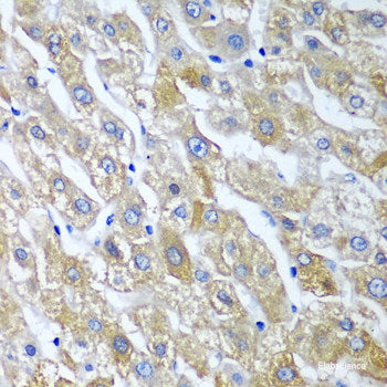 Immunohistochemistry of paraffin-embedded Human liver using UBE2U Polyclonal Antibody at dilution of 1:100 (40x lens).