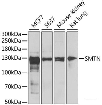 Immunohistochemistry of paraffin-embedded Human liver damage using SRGN Polyclonal Antibody at dilution of 1:200 (40x lens).