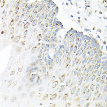 Immunohistochemistry of paraffin-embedded Human stomach using MRPL1 Polyclonal Antibody at dilution of 1:100 (40x lens).