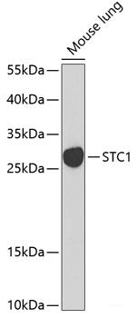 Western blot analysis of extracts of Mouse brain using RASGRF1 Polyclonal Antibody at dilution of 1:1000.
