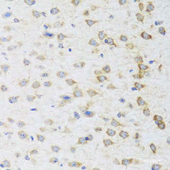 Immunofluorescence analysis of U2OS cells using KIF11 Polyclonal Antibody at dilution of 1:100. Blue: DAPI for nuclear staining.