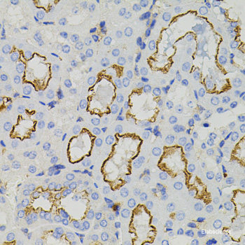 Immunofluorescence analysis of U2OS cells using NPR3 Polyclonal Antibody at dilution of 1:100. Blue: DAPI for nuclear staining.