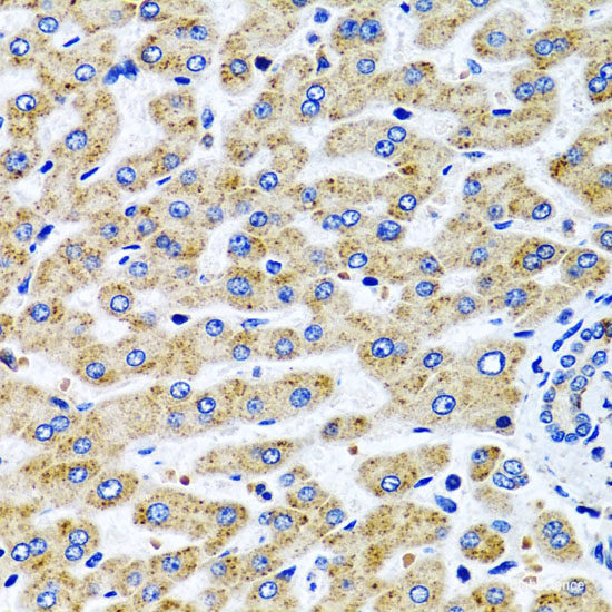 Immunofluorescence analysis of U2OS cells using SMYD2 Polyclonal Antibody