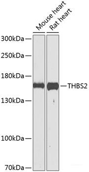 Western blot analysis of extracts of Jurkat cells using TBC1D1 Polyclonal Antibody at dilution of 1:3000.