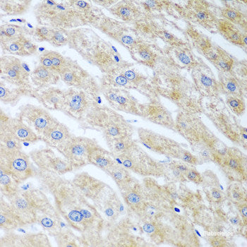 Immunohistochemistry of paraffin-embedded Human liver damage using RAB24 Polyclonal Antibody at dilution of 1:100 (40x lens).