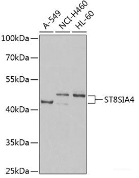 Immunohistochemistry of paraffin-embedded Rat kidney using RARRES2 Polyclonal Antibody at dilution of 1:200 (40x lens).