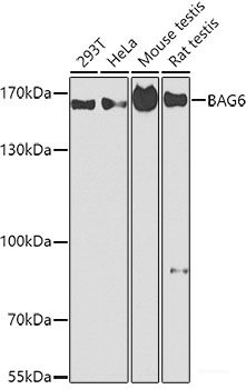 Immunohistochemistry of paraffin-embedded Human liver damage using CFH Polyclonal Antibody at dilution of 1:200 (40x lens).