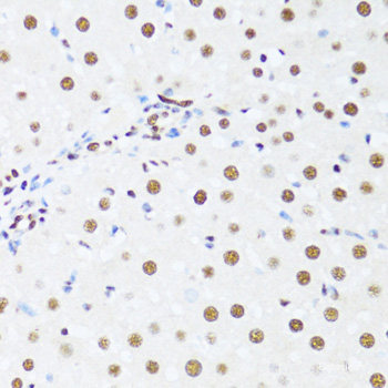 Immunohistochemistry of paraffin-embedded Mouse leydig cells using AMH Polyclonal Antibody at dilution of 1:100 (40x lens).