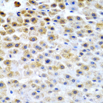 Immunohistochemistry of paraffin-embedded Human prostate using SPINT1 Polyclonal Antibody at dilution of 1:100 (40x lens).