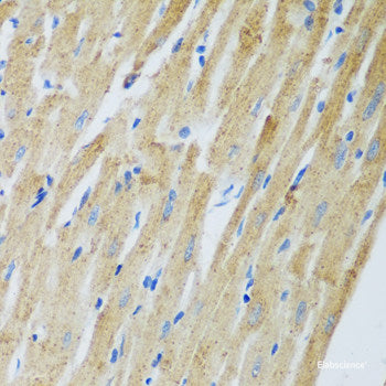 Western blot analysis of extracts from normal (control) and POR knockout (KO) HeLa cells using POR Polyclonal Antibody at dilution of 1:1000.