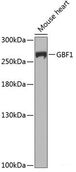 Confocal immunofluorescence analysis of U2OS cells using ARL8B Polyclonal Antibody at dilution of 1:100. Blue: DAPI for nuclear staining.