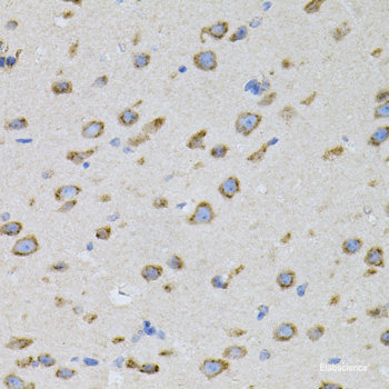 Immunohistochemistry of paraffin-embedded Human liver using SGSH Polyclonal Antibody at dilution of 1:100 (40x lens).