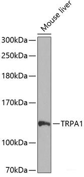 Western blot analysis of extracts of Mouse heart using SPAST Polyclonal Antibody at dilution of 1:3000.