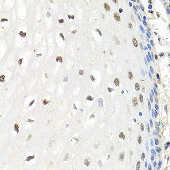 Immunohistochemistry of paraffin-embedded Mouse lung using DCP2 Polyclonal Antibody at dilution of 1:100 (40x lens).
