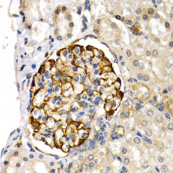 Immunohistochemistry of paraffin-embedded Human normal breast using TOR1A Polyclonal Antibody at dilution of 1:200 (40x lens).