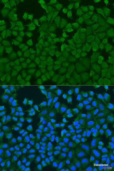 Western blot analysis of extracts of HeLa cells using COX7A2 Polyclonal Antibody at dilution of 1:1000.