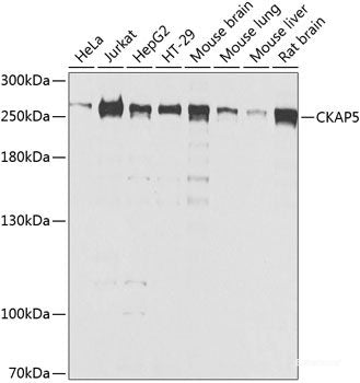 Western blot analysis of extracts of various cell lines using CRYGC Polyclonal Antibody at dilution of 1:1000.