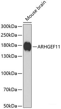 Western blot analysis of extracts of various cell lines using TRPC6 Polyclonal Antibody at dilution of 1:1000.