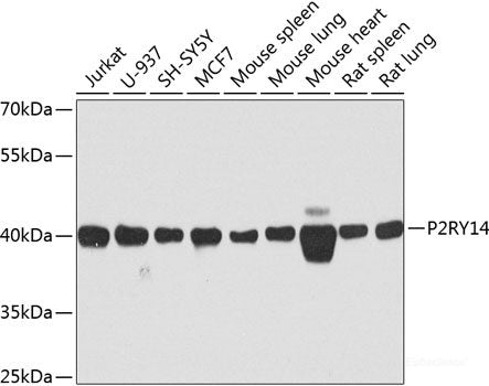 Immunohistochemistry of paraffin-embedded Rat spleen using CR2 Polyclonal Antibody at dilution of 1:100 (40x lens).