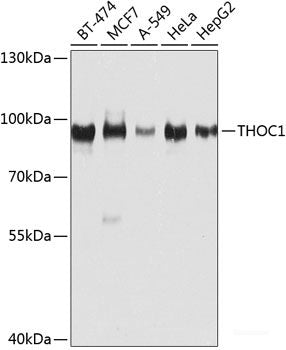 Immunohistochemistry of paraffin-embedded Rat brain using CRHR1 Polyclonal Antibody at dilution of 1:100 (40x lens).
