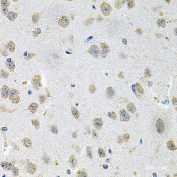 Western blot analysis of extracts of Human testis using SYCP3 Polyclonal Antibody.