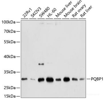 Western blot analysis of extracts of various cell lines using Acetyl-Histone H4-K16 Polyclonal Antibody at dilution of 1:1000.