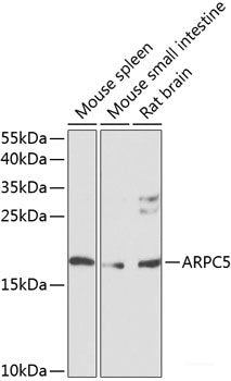 Western blot analysis of extracts of various cell lines using ZRANB3 Polyclonal Antibody at dilution of 1:3000.