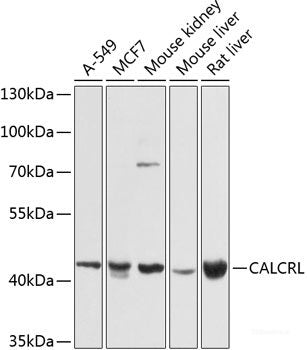 Western blot analysis of extracts of Rat brain using SRR Polyclonal Antibody at dilution of 1:1000.