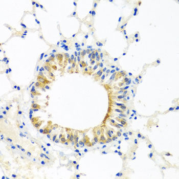Immunohistochemistry of paraffin-embedded Mouse brain using NAPA Polyclonal Antibody