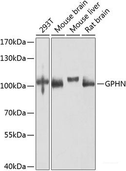 Western blot analysis of extracts of various cell lines using UBQLN2 Polyclonal Antibody at dilution of 1:1000.