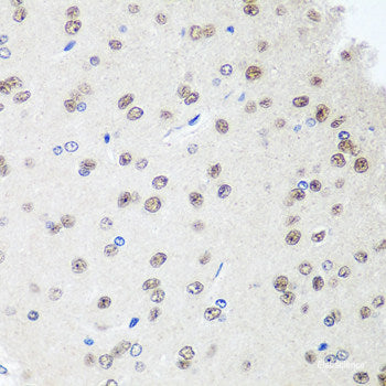 Immunohistochemistry of paraffin-embedded Rat testis using CCNG1 Polyclonal Antibody at dilution of 1:100 (40x lens).