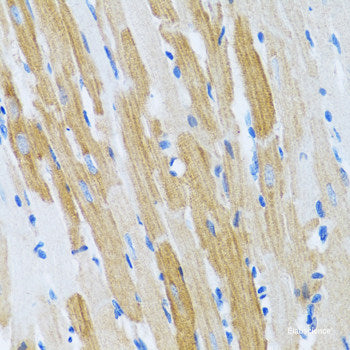 Immunohistochemistry of paraffin-embedded Human prostate using STK3 Polyclonal Antibody at dilution of 1:100 (40x lens).