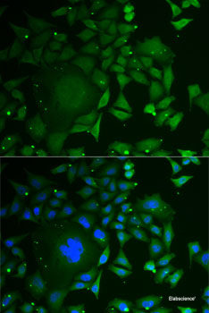 Immunohistochemistry of paraffin-embedded Rat heart using GPLD1 Polyclonal Antibody at dilution of 1:100 (40x lens).
