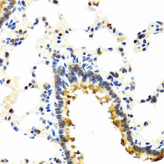 Western blot analysis of extracts of MCF-7 cells using C10orf2 Polyclonal Antibody at dilution of 1:1000.