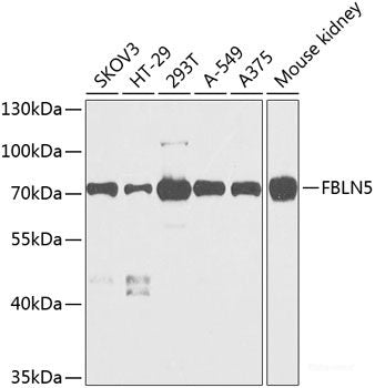 Western blot analysis of extracts from 293 cells using Phospho-IGF1R(Y1161) Polyclonal Antibody.