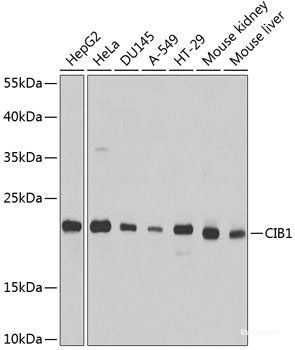 Immunofluorescence analysis of A-549 cells using CUL2 Polyclonal Antibody