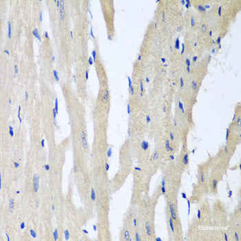 Western blot analysis of extracts of various cell lines using GLP1R Polyclonal Antibody at dilution of 1:1000.