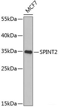 Immunohistochemistry of paraffin-embedded Rat heart using MAP2K5 Polyclonal Antibody at dilution of 1:100 (40x lens).