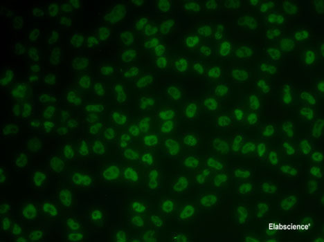 Immunohistochemistry of paraffin-embedded Rat heart using WFDC2 Polyclonal Antibody at dilution of 1:100 (40x lens).