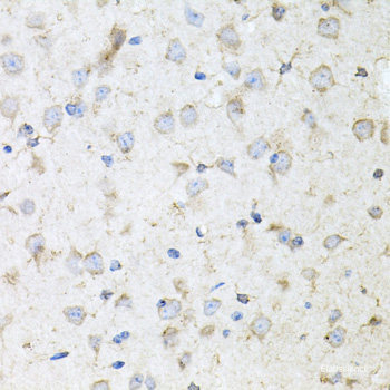 Western blot analysis of extracts of various cell lines using Bcl9 Polyclonal Antibody at dilution of 1:400.