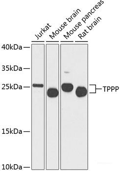 Western blot analysis of extracts of various cell lines using HACE1 Polyclonal Antibody at dilution of 1:1000.