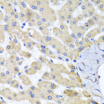 Immunofluorescence analysis of A549 cells using TRIM63 Polyclonal Antibody