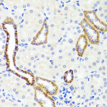 Western blot analysis of extracts of various cell lines using DDOST Polyclonal Antibody at dilution of 1:1000.