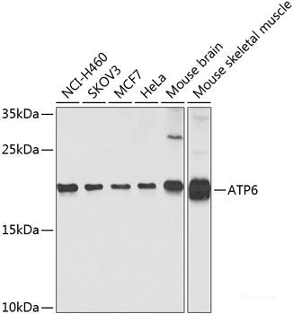 Immunohistochemistry of paraffin-embedded Rat brain using EPHA3 Polyclonal Antibody at dilution of 1:100 (40x lens).