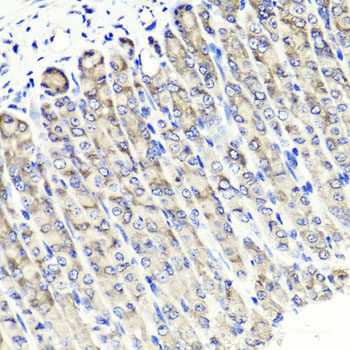 Western blot analysis of extracts of Mouse spleen using TCF7 Polyclonal Antibody at dilution of 1:300.