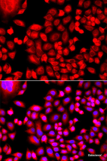 Western blot analysis of extracts of various cell lines using FZD4 Polyclonal Antibody at dilution of 1:1000.